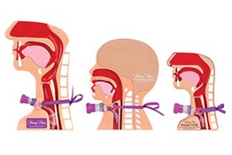 Passy Muir Educational Models